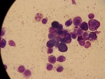 mastocytoom cytologie